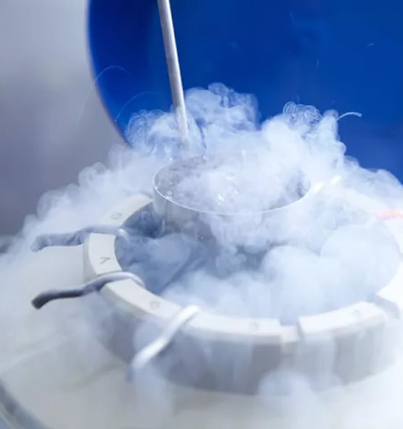 embryo-cryopreservation