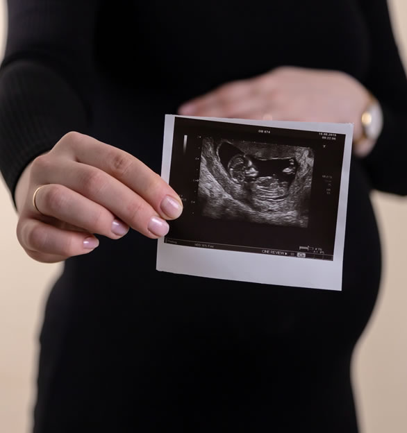 Embryo Transfer